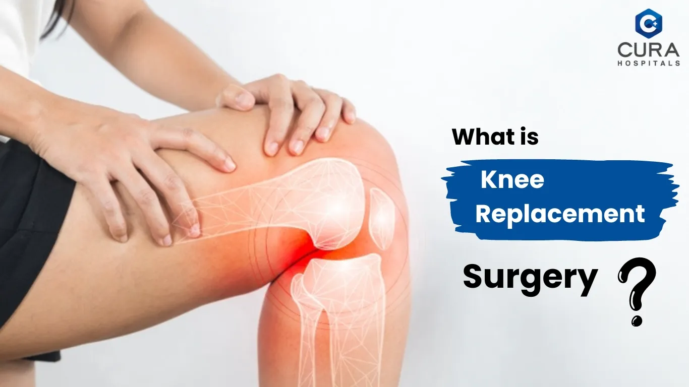 Understanding Knee Replacement Surgery: A Guide to Recovery with the Top Knee Replacement Surgeon in Kanakapura Road