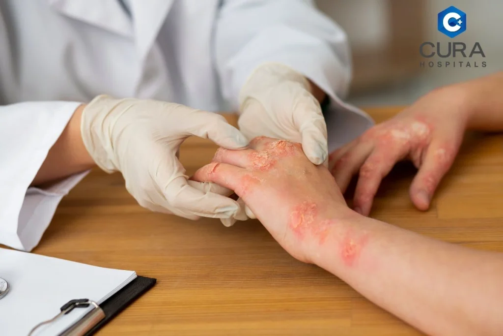 Skin Infections You Shouldn’t Ignore: Expert Care from a Dermatologist in Bangalore