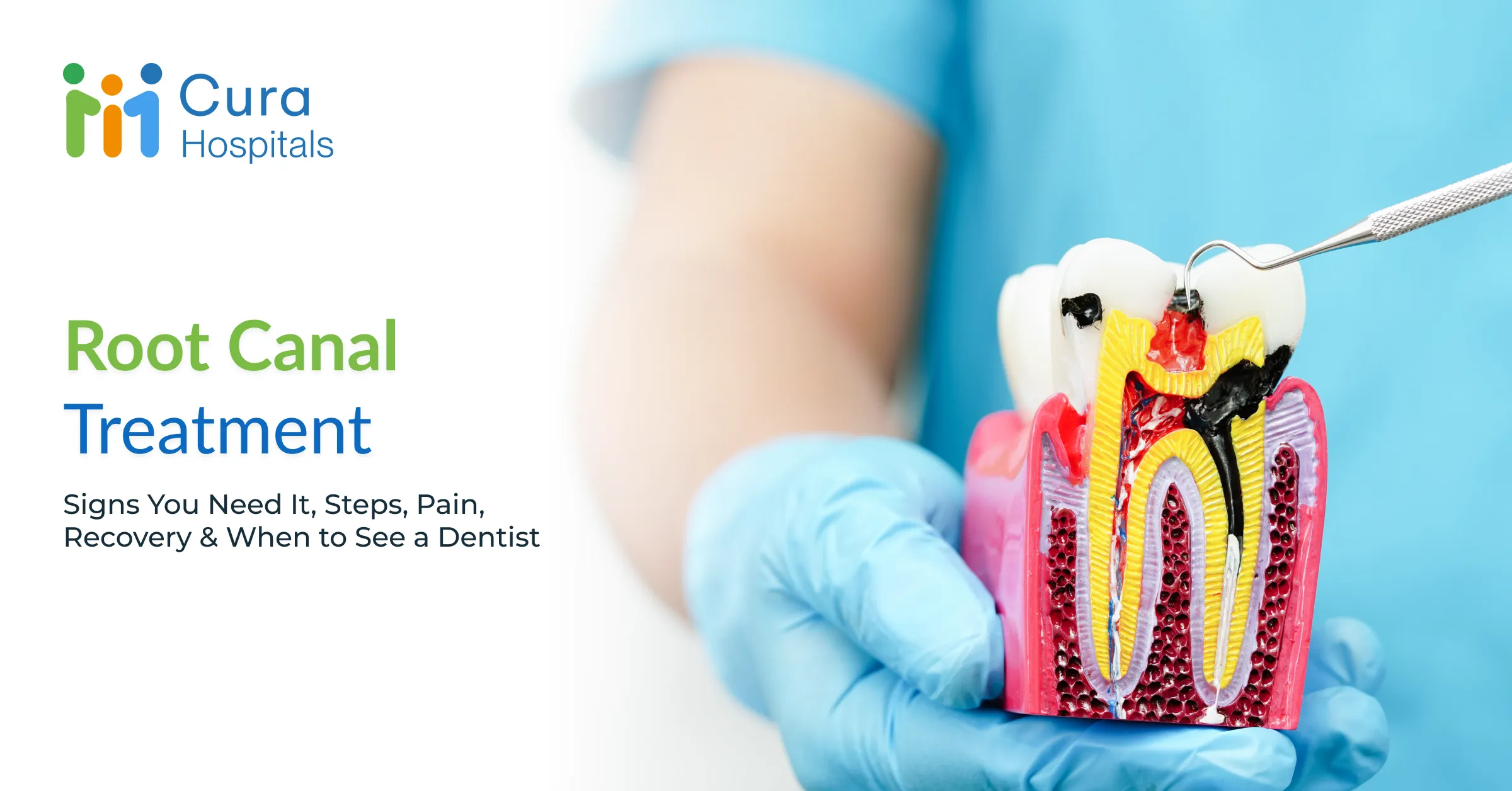 Root Canal Treatment: Signs You Need It, Steps, Pain, Recovery & When to See a Dentist