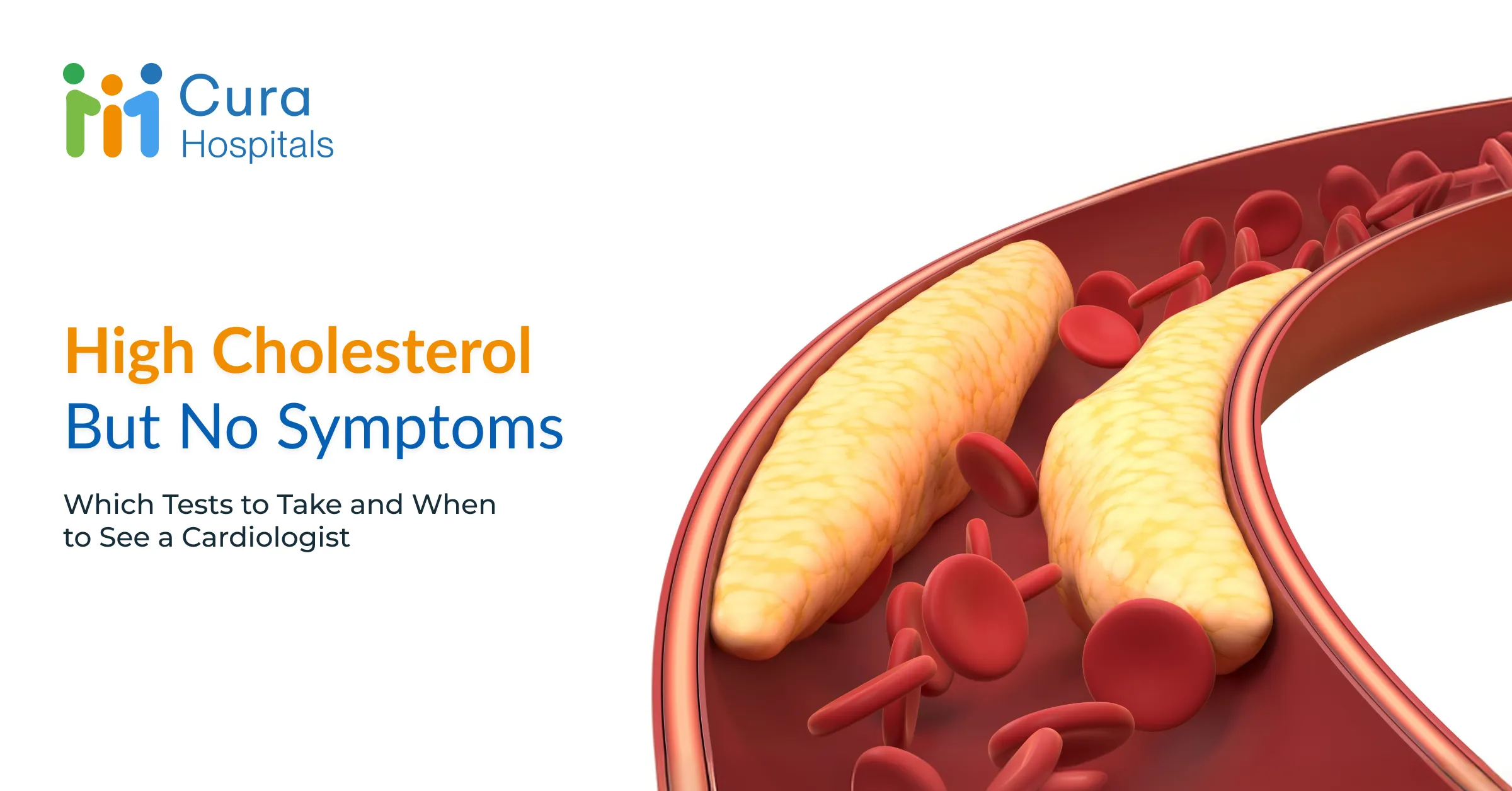 High Cholesterol but No Symptoms: Which Tests to Take and When to See a Cardiologist
