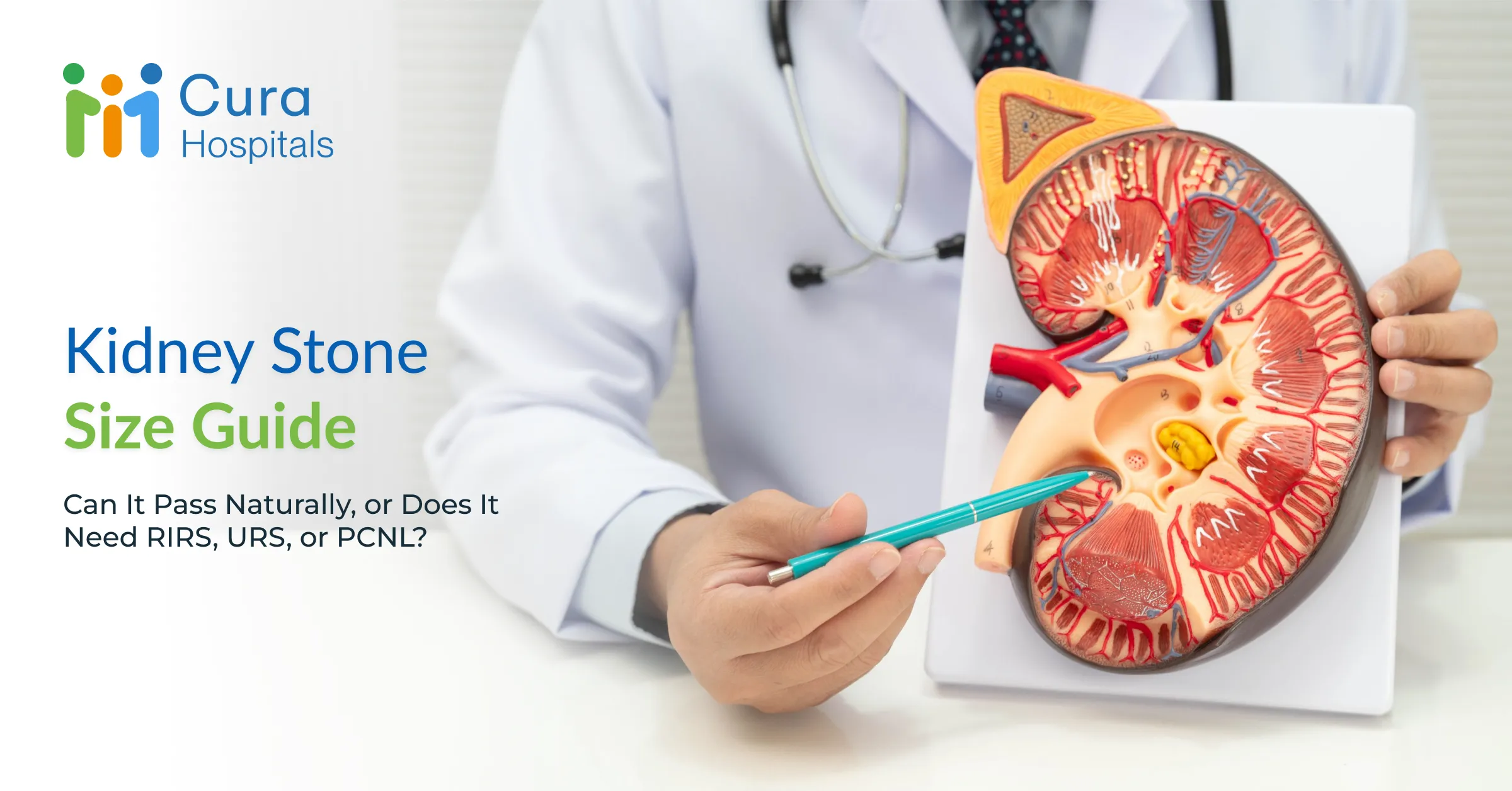 Kidney Stone Size Guide: Can It Pass Naturally, or Does It Need RIRS, URS, or PCNL?
