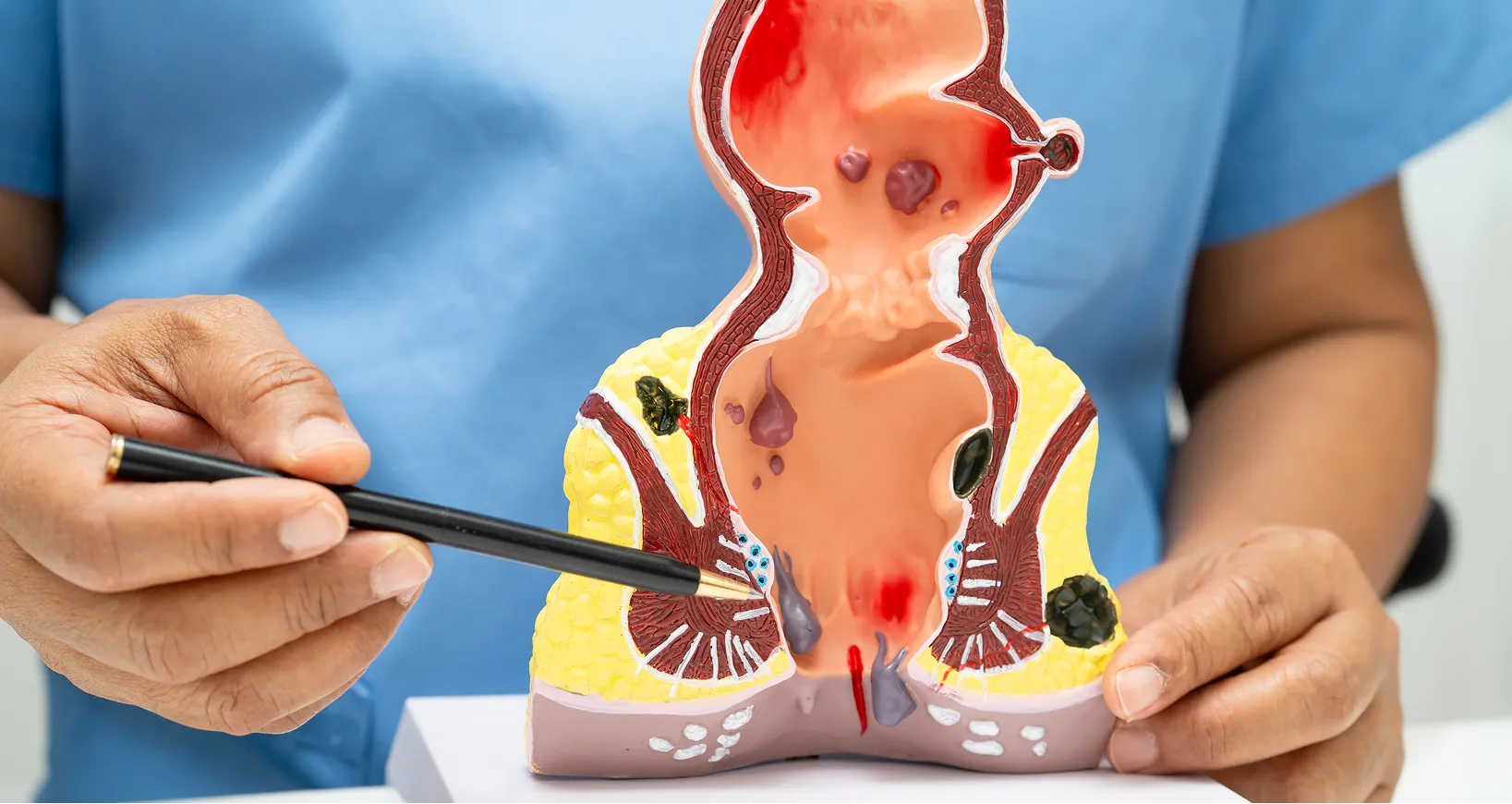 Anorectal Surgery