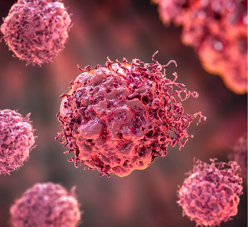 Glottic, Supraglottic, and Subglottic Cancer: 