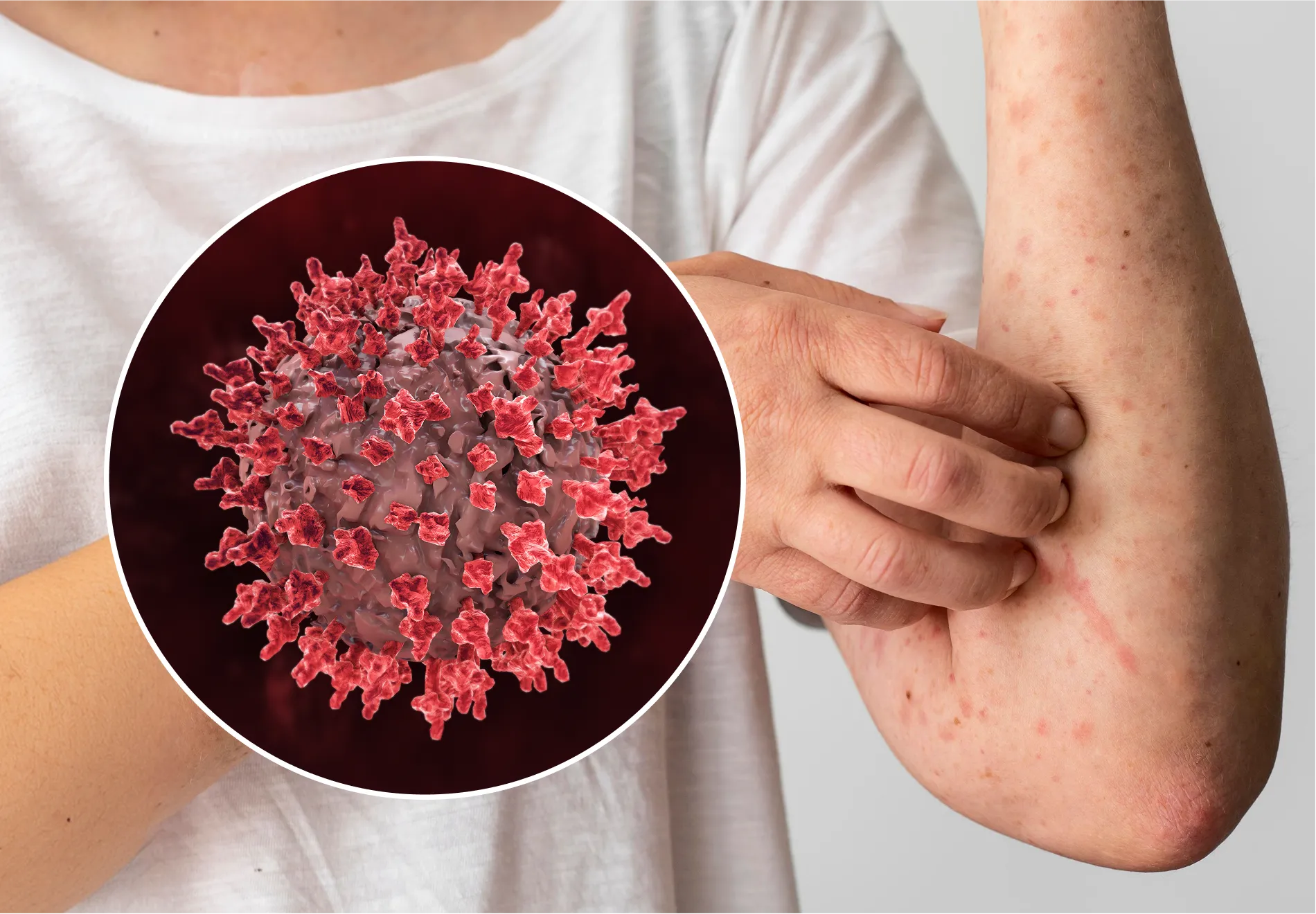 Allergies & Immune System Treatments