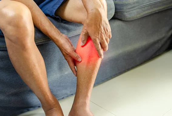 Symptoms of <em>Deep Vein Thrombosis</em>