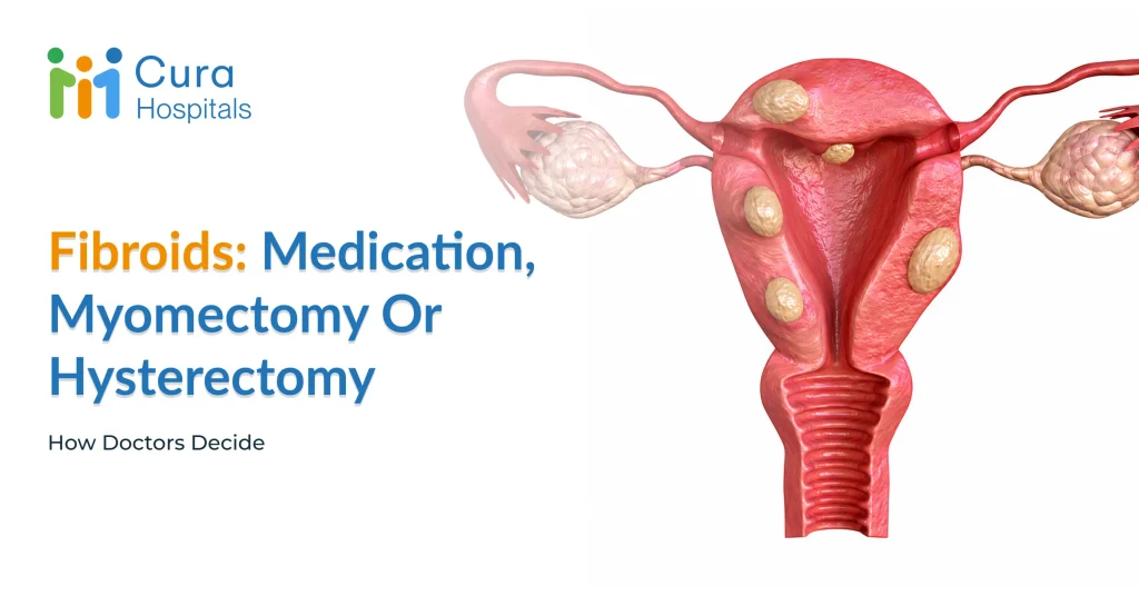 Fibroid Treatment: Medication, Myomectomy or Hysterectomy