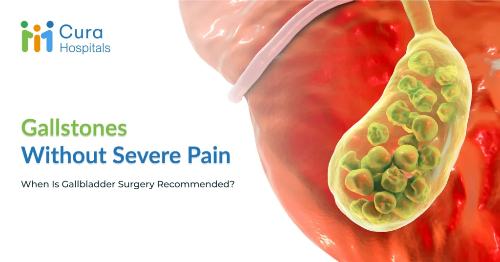 Gallstones Without Severe Pain: When Is Gallbladder Surgery Recommended?