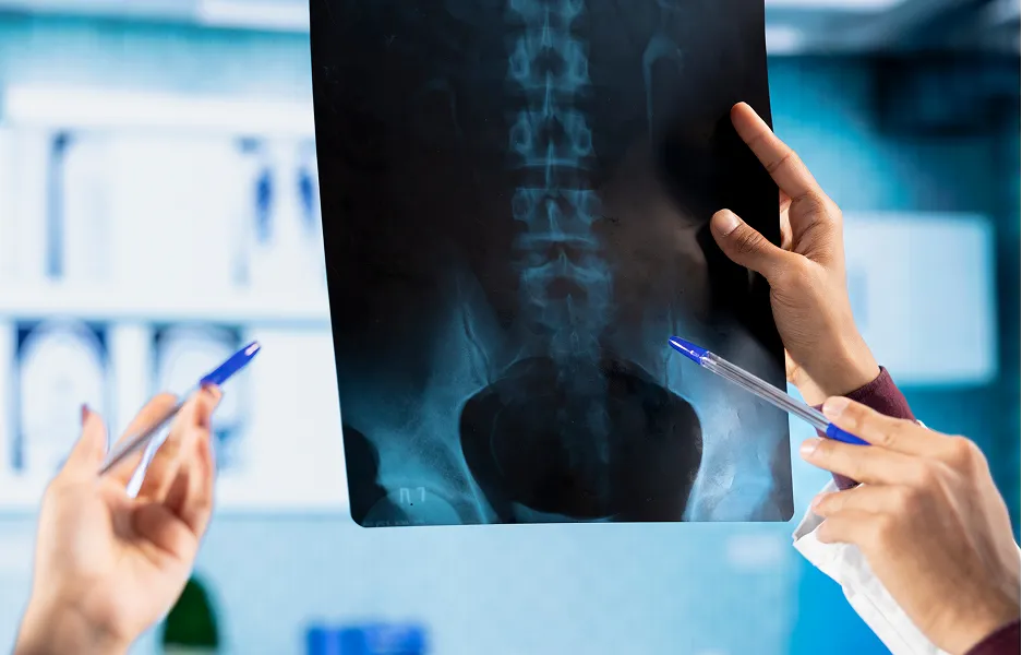 Surgery Recommended Only When Justified