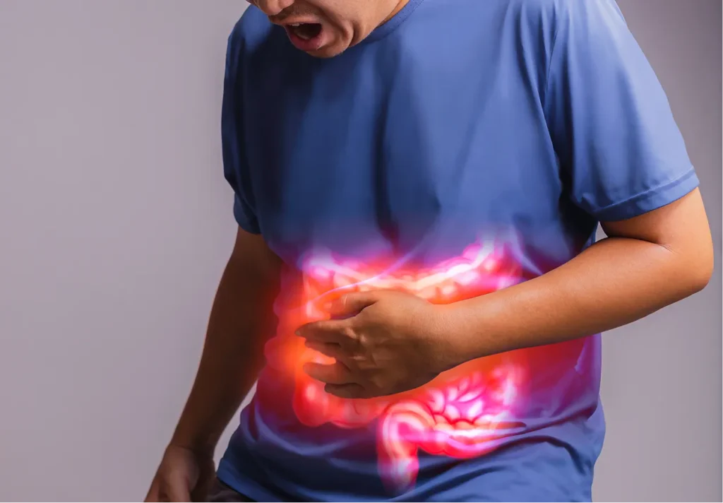 Crohn’s Disease