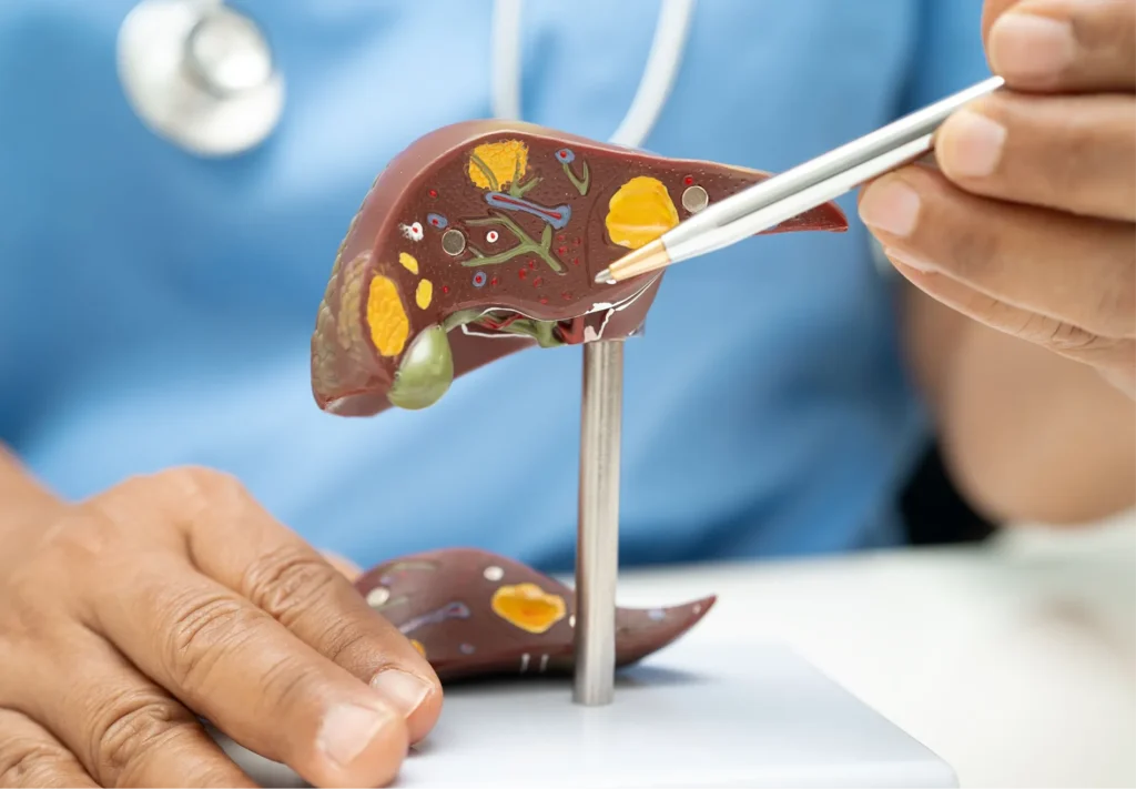 Liver Cancer