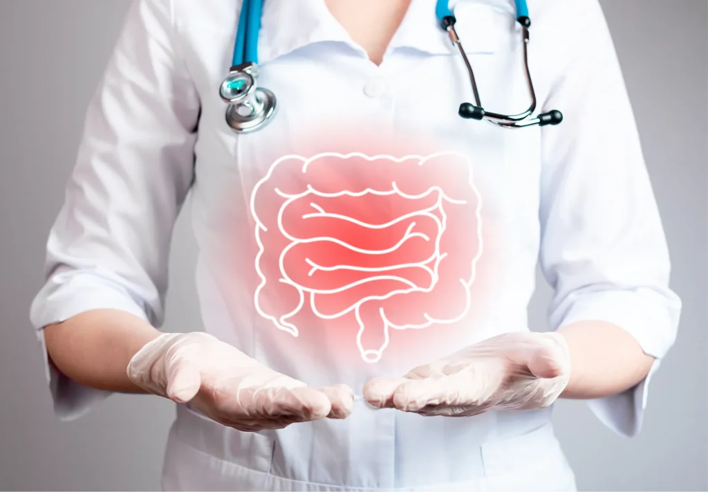 Inflammatory Bowel Disease (IBD)