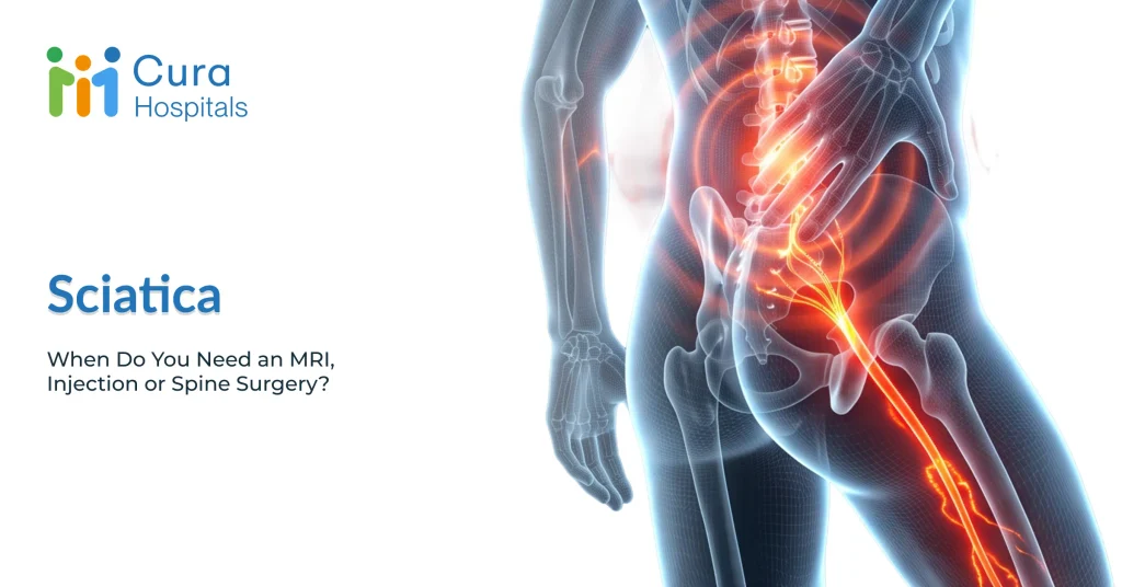 Sciatica: When Do You Need an MRI, Injection or Spine Surgery?
