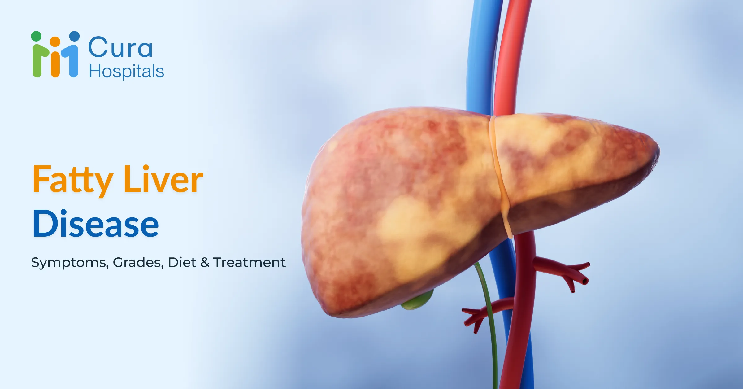 Fatty Liver Disease – Symptoms, Causes, Grades, Diet and Treatment