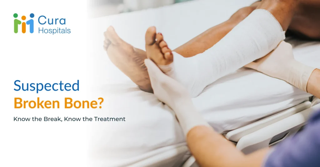 Fracture First Aid – What to Do Immediately After a Suspected Broken Bone