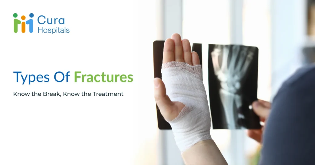 What Are the Different Types of Fractures and Their Treatment Options?
