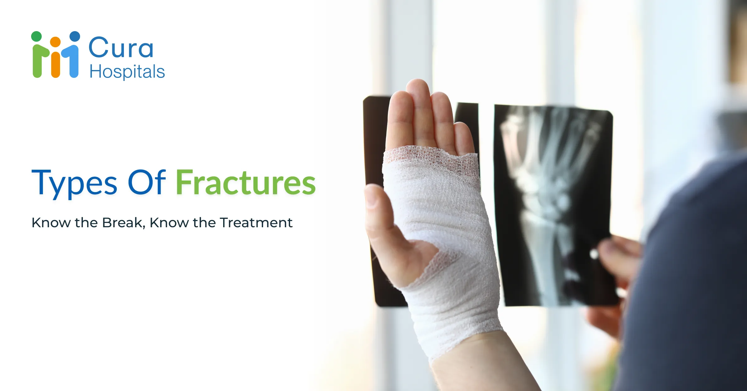 What Are the Different Types of Fractures and Their Treatment Options?